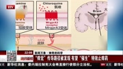 “痒觉＂传导路径被发现有望＂催生”特效止痒药资讯搜索最新资讯爱奇艺