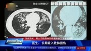 医生:长期吸入致肺损伤资讯搜索最新资讯爱奇艺