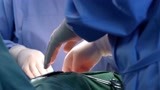 产科医生：妇产科进修医生，做开胸手术，用手按压心脏