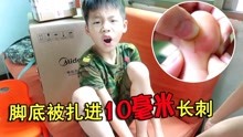 [图]小男孩太调皮在床上跳，脚扎进10毫米长刺，他担心要动手术